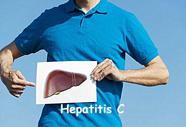 丙型肝炎病毒检测